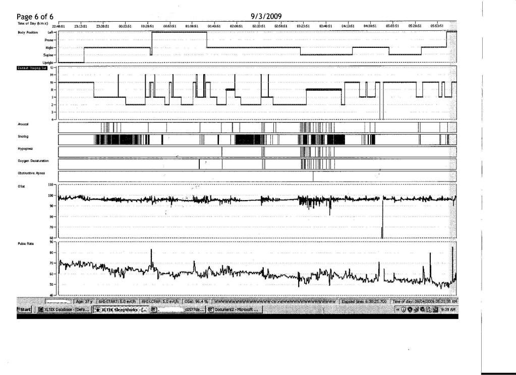 Sleep Study Graph Chart Photo by 53dragondriver Photobucket