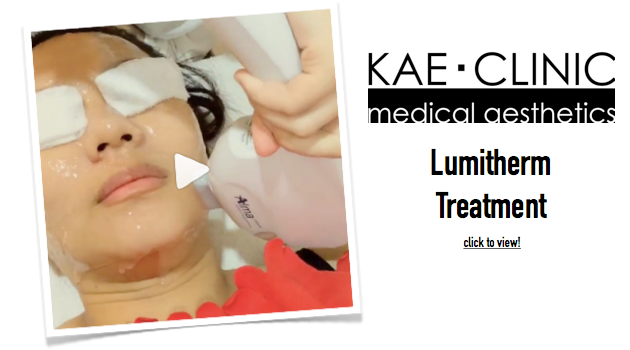 Lumitherm Treat at KAE Clinic photo Lumitherm001_zpsbf91ea2c.png