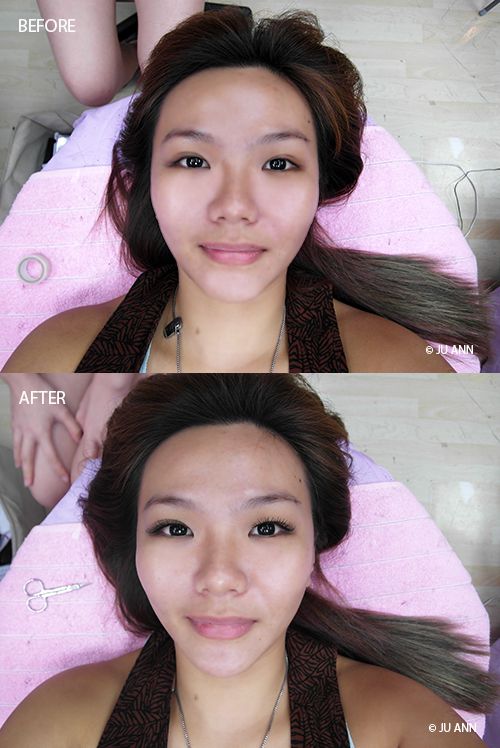 Angel Xin Beauty Before and After