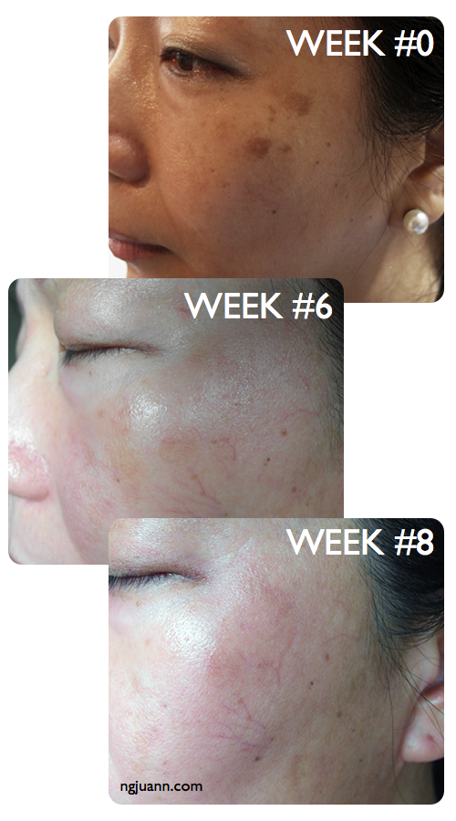 Obagi Toning Treat Melasma